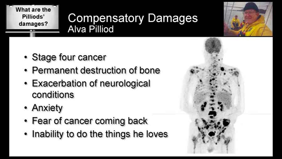 Scan showing all the lesions and tumors in Alva Pilliod's body